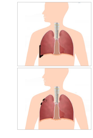 DISEASES-1.jpg