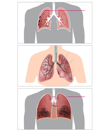 DISEASES.jpg